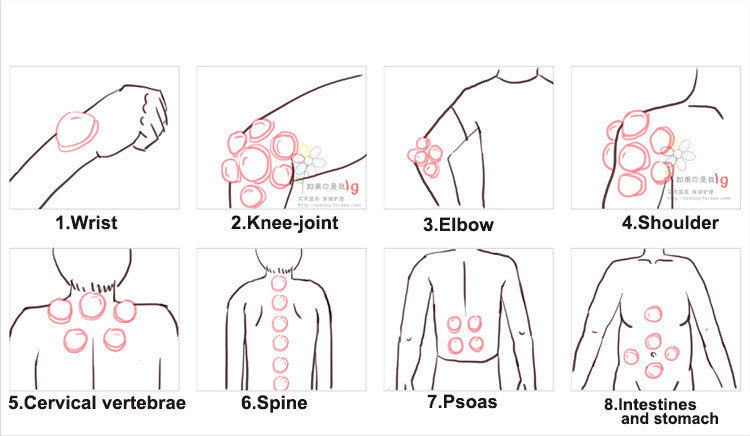 Silicone vacuum cupping cupper