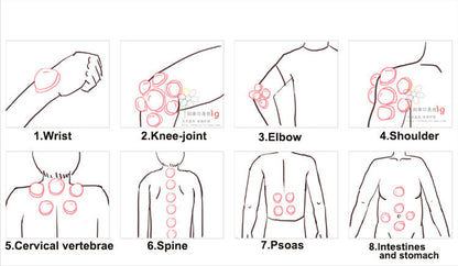 Silicone vacuum cupping cupper